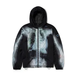   Aries X-Ray Windcheater Jacket 'Black'